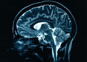 mri-of-human-brain